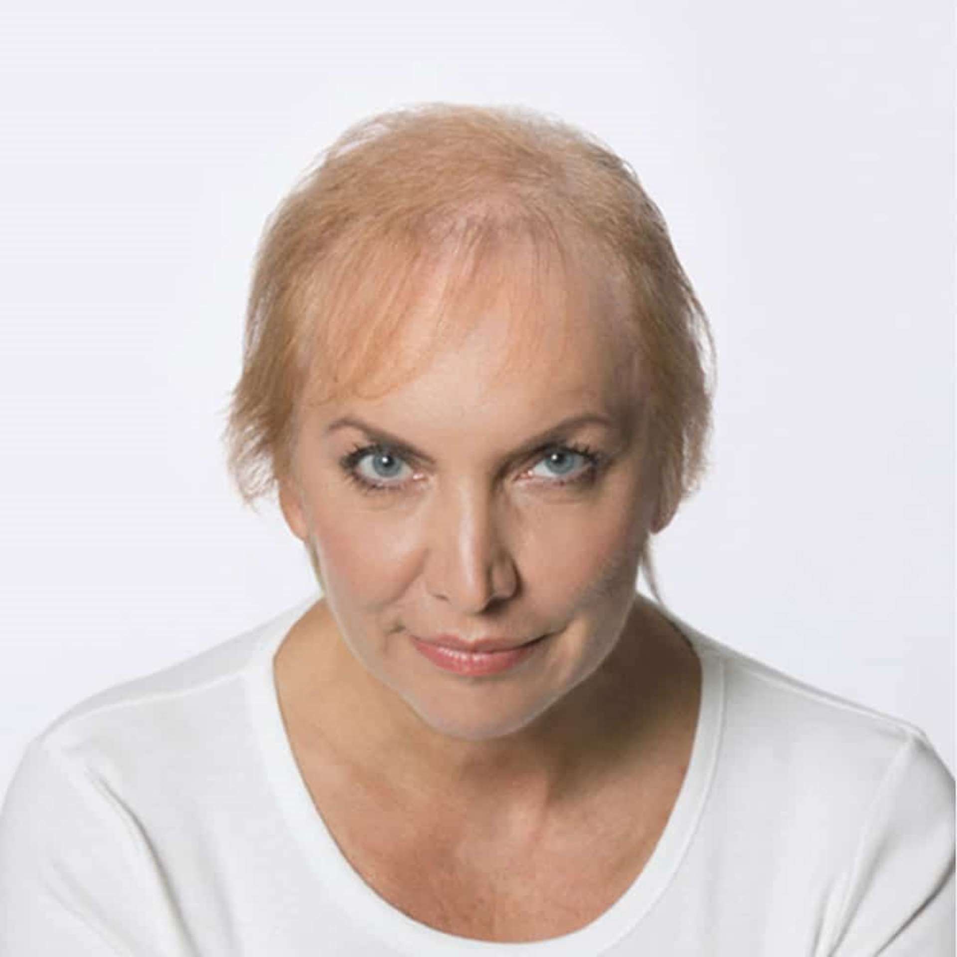 Frau mit wenig blonden Haaren am Kopf